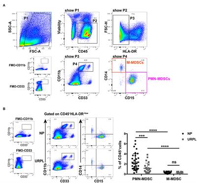 Upregulated TRAIL and Reduced DcR2 Mediate Apoptosis of Decidual PMN-MDSC in Unexplained Recurrent Pregnancy Loss